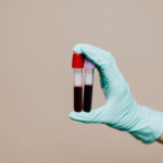 Hemoglobin Kitna Hona Chahiye