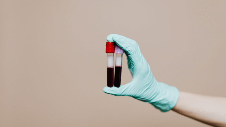 Hemoglobin Kitna Hona Chahiye
