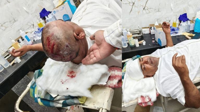 SP Leader Gayatri Prajapati Injured in Lucknow Jail Attack